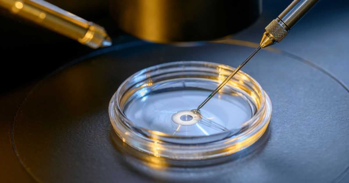 体外受精（IVF ）