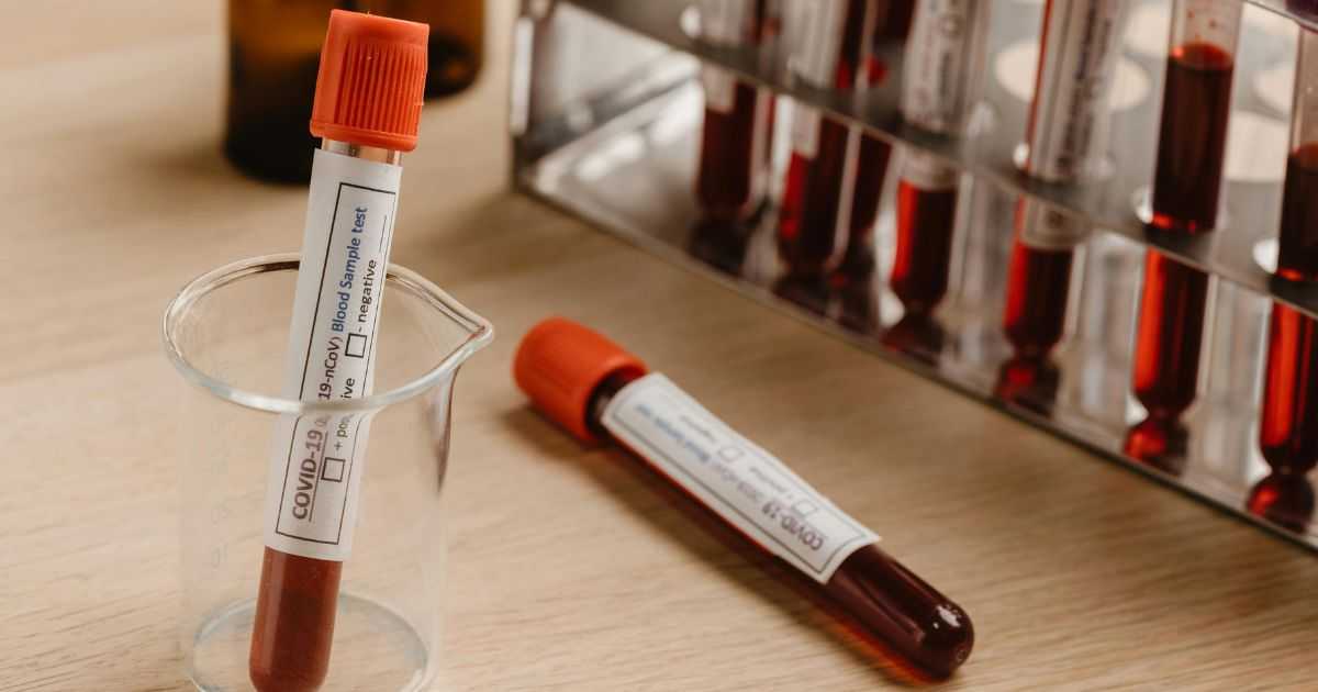AMH検査：卵巣の状態を理解するための重要な指標