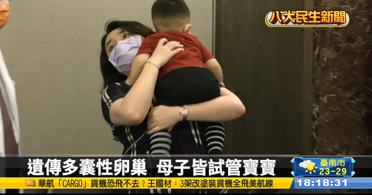 多囊性卵巢易遺傳 嚴重可能不孕
